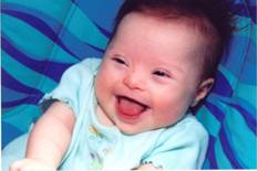5-DE-AGOSTO_SINDROME-DOWN.jpg