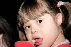 SINDROME DE down.jpg